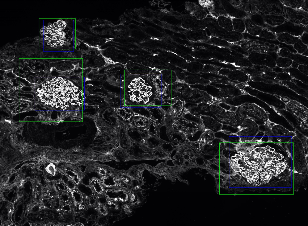 Glomeruli Detection in Whole-Slide Images