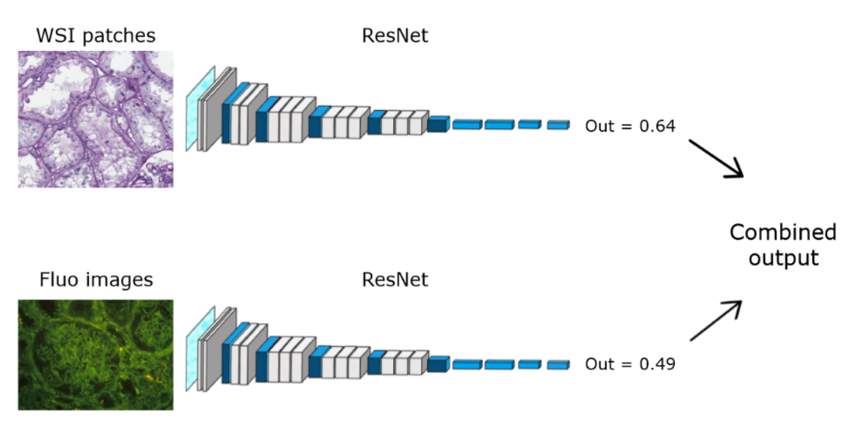 Prediction of Kidney Failure using Deep Neural Networks