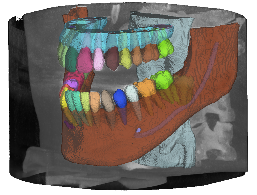 Multi-Structure Segmentation in CBCT Volumes: the ToothFairy2 Challenge